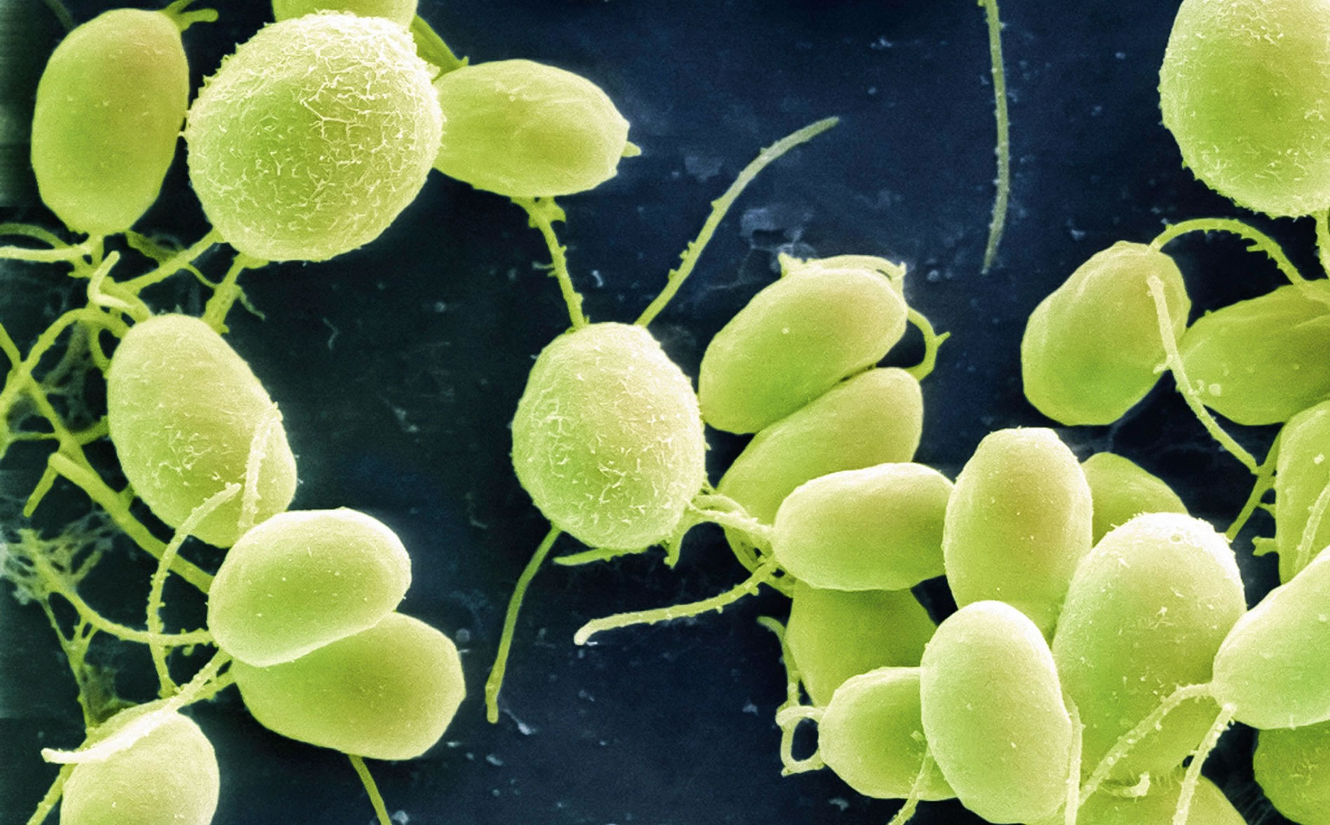 一种简单的单细胞绿藻或可成为治疗失明的手段