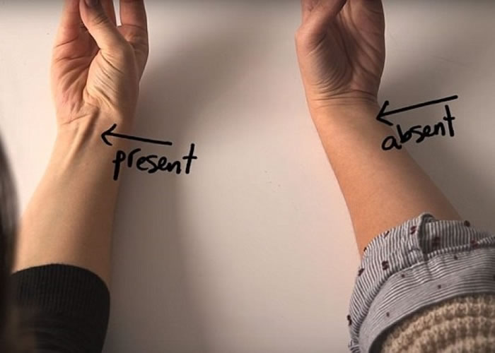 检查你手腕下有没有"掌长肌"突出来 有就证明你遗传到人类祖先留下来