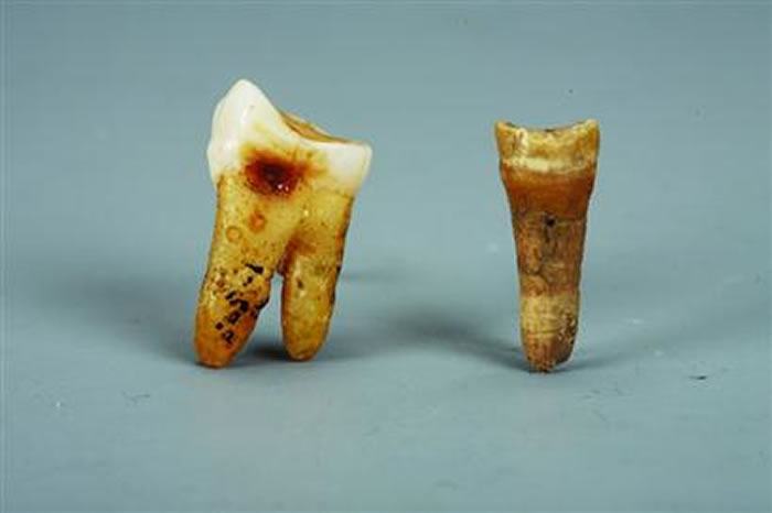 古人类牙齿化石.