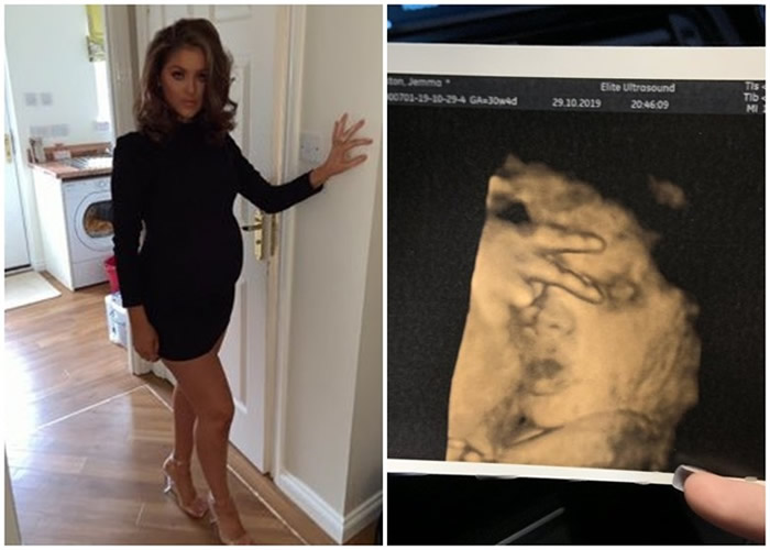英国孕妇做4d超声波惊见到腹中小公主伸出2只手指摆出"反v"手势